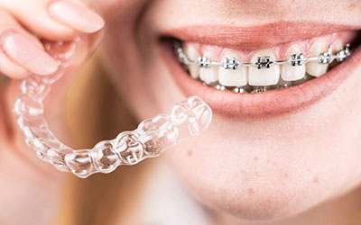歯並びとともにお口を健康にする　矯正治療