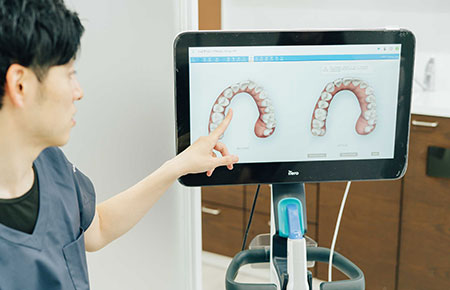 口腔内スキャナーで不快感なく歯の型採りを行う